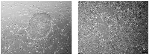 iPS細胞の形態の比較