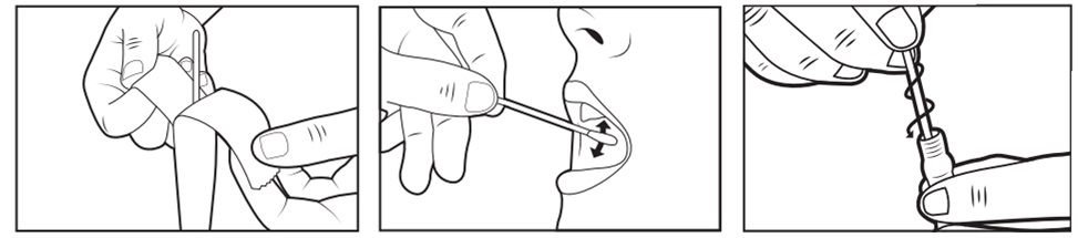 口腔からのDNA試料採取・保存用器具の外観