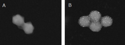 Ni-NTA-Nanogoldの走査透過型電子顕微鏡像
