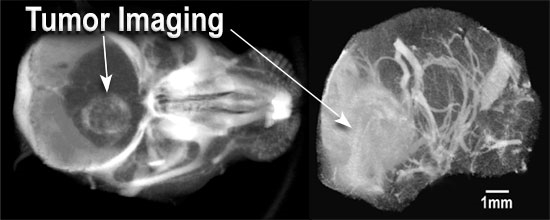 AuroVist-15 nmを注入したマウス脳腫瘍のMicroCT像