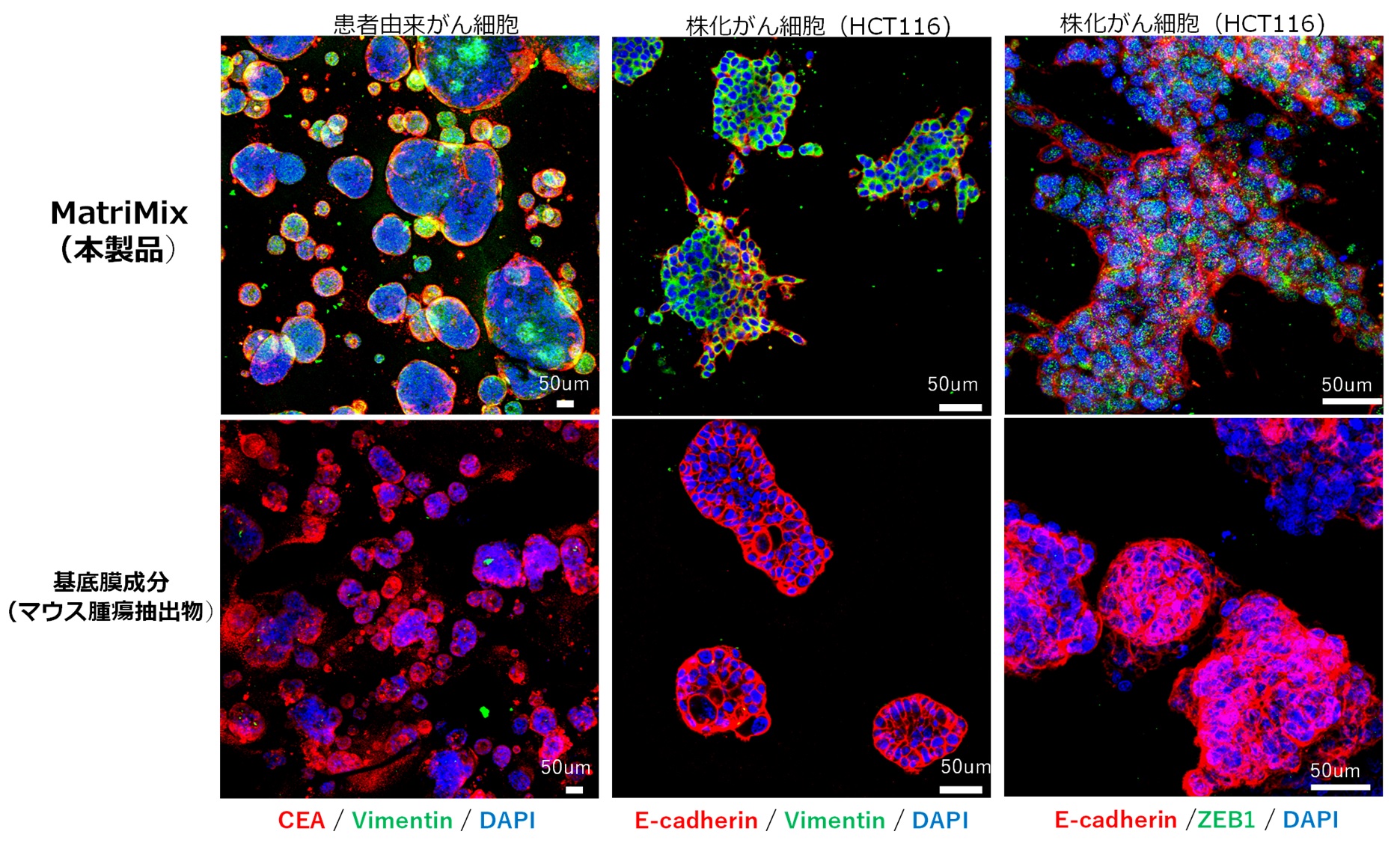 例4 MatriMix511を用いた大腸がん細胞のオルガノイド形成誘導