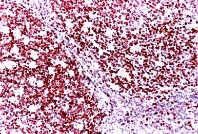 ヒト扁桃腺組織パラフィン包埋切片を抗Ki67抗体（#NB500-170）で免疫染色した。