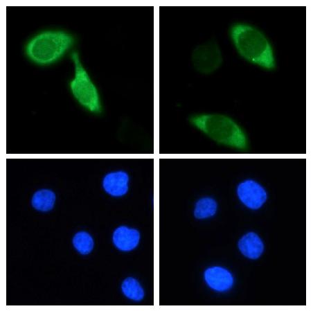 CRISPR/Cas9研究に有用な抗体  抗Cas9抗体(Anti-Cas9 Antibody)の免疫細胞染色像
