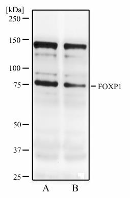 転写因子FOXP1に対する抗体 抗FOXP1抗体