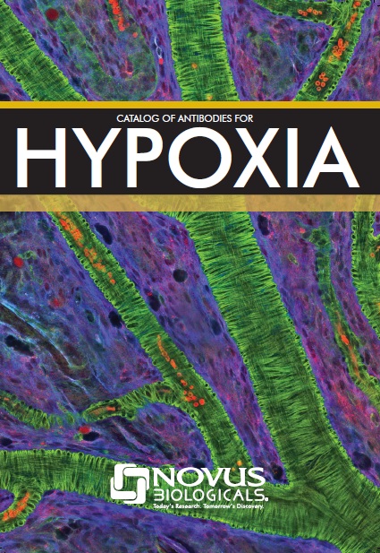 Catalog of Antibodies for Hypoxia