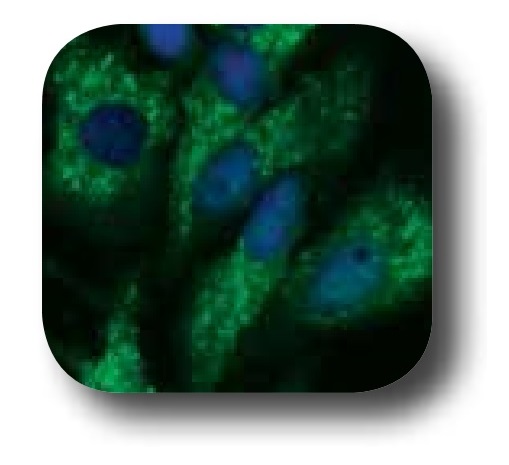 抗LC3B/MAP1LC3B抗体を用いた蛍光免疫染色像