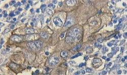 各種卵巣腫瘍のマーカーに対する抗体 抗卵巣腫瘍マーカー抗体