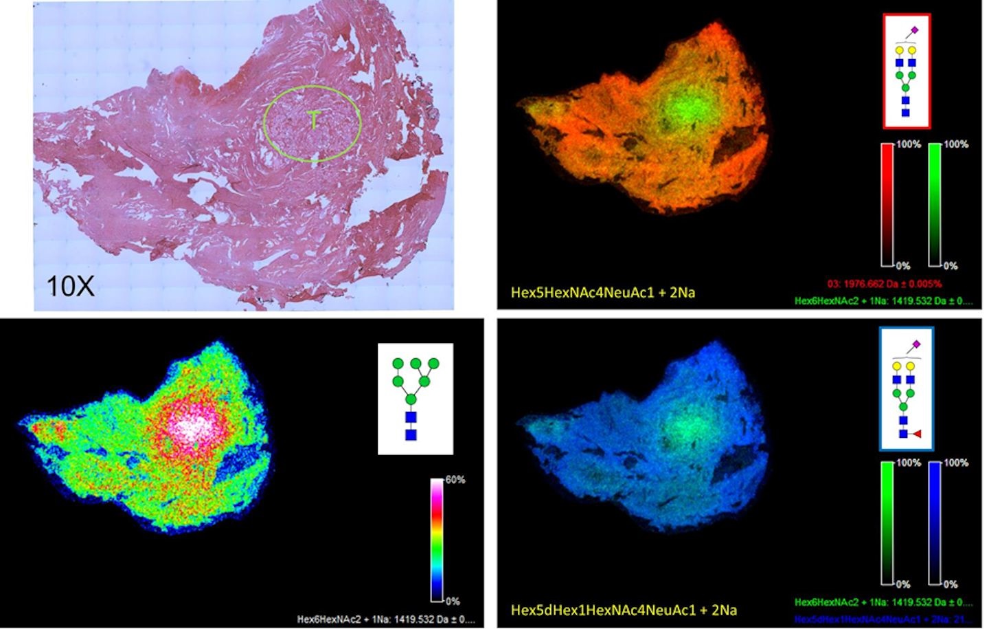 PNGase F PRIMEで処理したホルマリン固定パラフィン包埋ヒト前立腺組織のN型糖鎖イメージング解析像