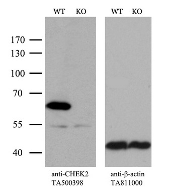 抗Mouse CHEK2抗体(#TA500398)のウエスタンブロッティング像