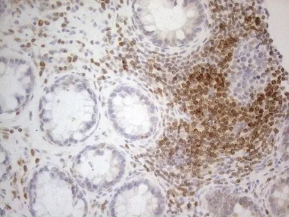 抗BCL2モノクローナル抗体で、ヒト結腸組織を染色した写真。