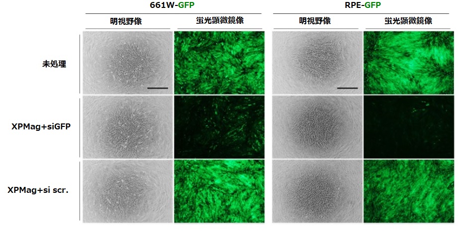 網膜細胞株661WおよびRPEにおける遺伝子サイレンシング