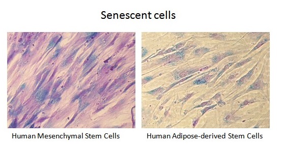 細胞老化マーカーβガラクトシダーゼ（senescence-associated β-galactosidase, SABG）を染色するキット Senescence Kit