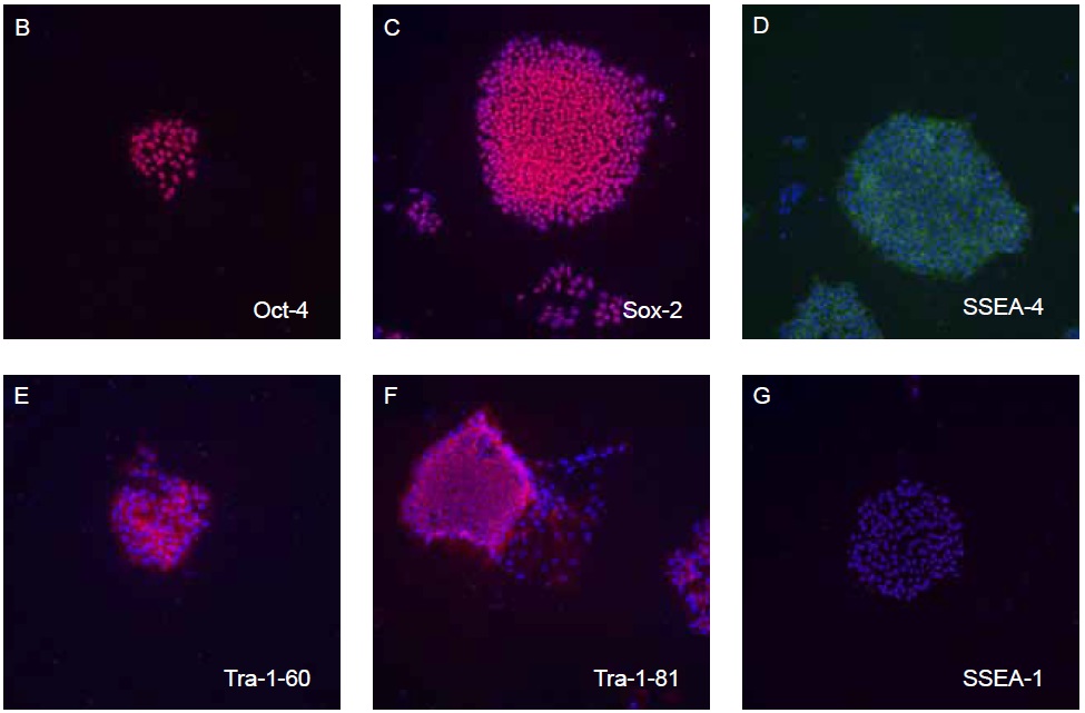 ヒト多能性幹細胞用培地hPSC Growth Medium DXFの使用例B