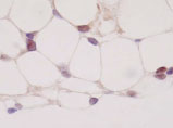 抗核内レセプターモノクローナル抗体(抗核内受容体抗体)
