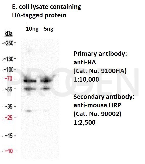 抗HAタグ抗体を用いたウエスタンブロッティング像