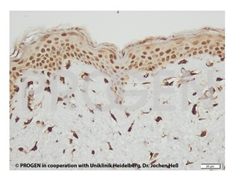 ウサギ抗ヒスチジンデカルボキシラーゼ抗体およびprohisto-HiSec Anti-abbit HRPを使用したヒト皮膚組織の免疫組織染色