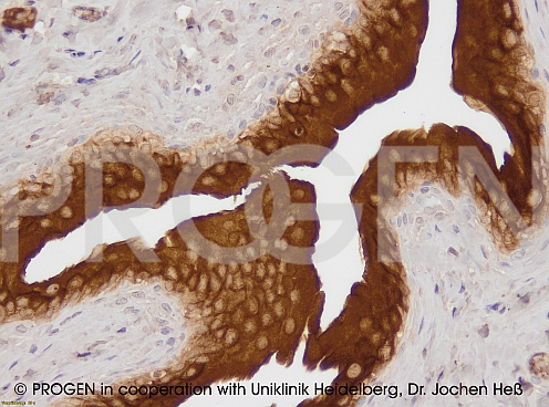 抗Aquaporin4抗体免疫組織染色（免疫細胞染色）イメージ