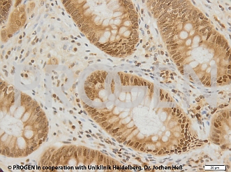抗p62/ SQSTM1抗体によるヒト結腸染色イメージ
