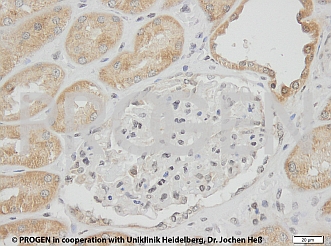 抗p62/ SQSTM1抗体によるヒト腎臓染色イメージ