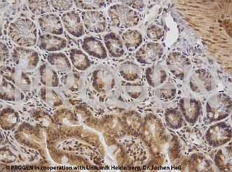 抗p62/ SQSTM1抗体によるマウス結腸染色イメージ