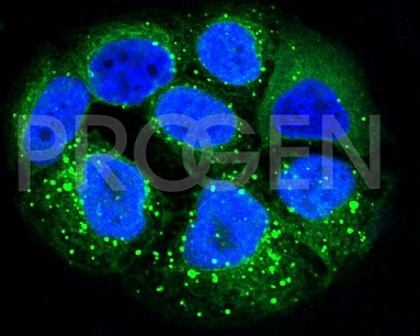 抗p62/ SQSTM1抗体による肝臓がん細胞PLCの染色イメージ