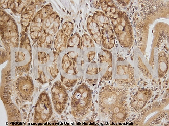 抗p62/ SQSTM1抗体によるラット結腸染色イメージ