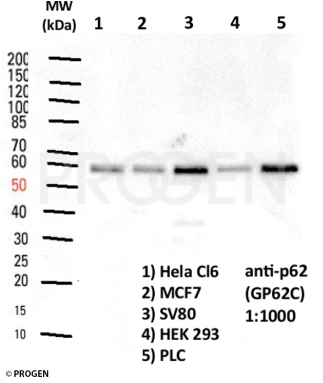 抗p62/ SQSTM1抗体による各種細胞抽出物ウェスタンブロットイメージ