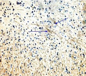 抗Neuromedin U抗体（#H-046-41）を用いたラット 腹側視床下部の免疫染色像