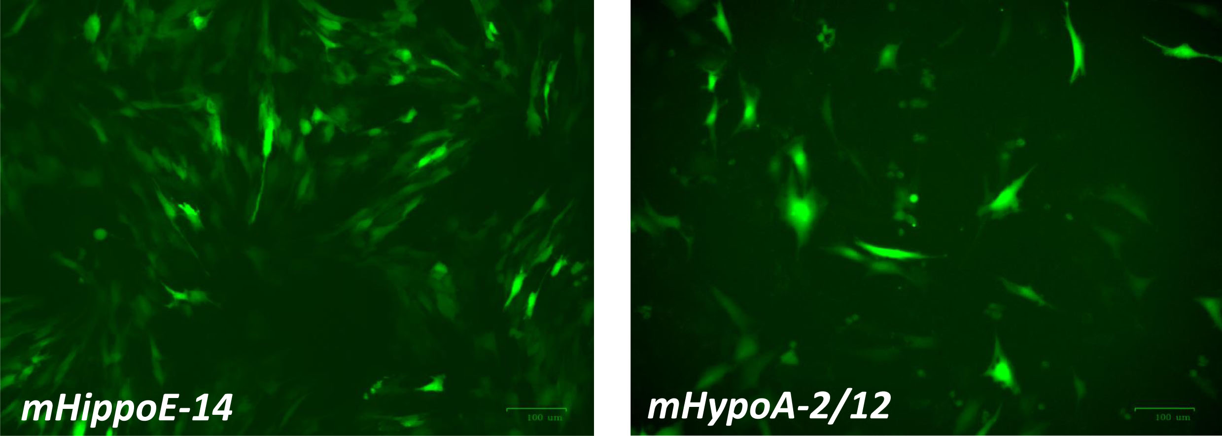 胚性マウス海馬細胞および成体マウス海馬細胞にEGFPプラスミドをトランスフェクション