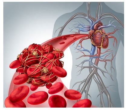血栓症タンパク質と血液のイメージイラスト