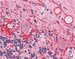 ヒト小脳組織の免疫組織染色像