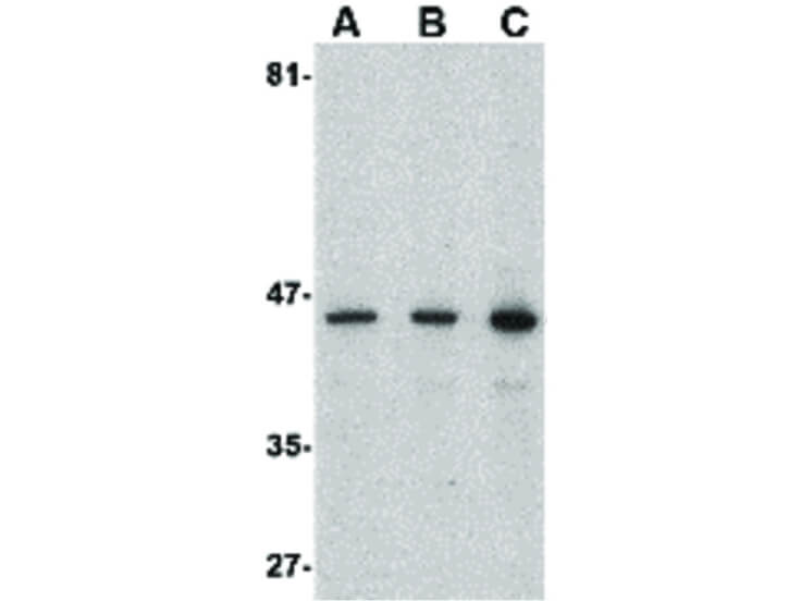 Presenilin1 Antibody