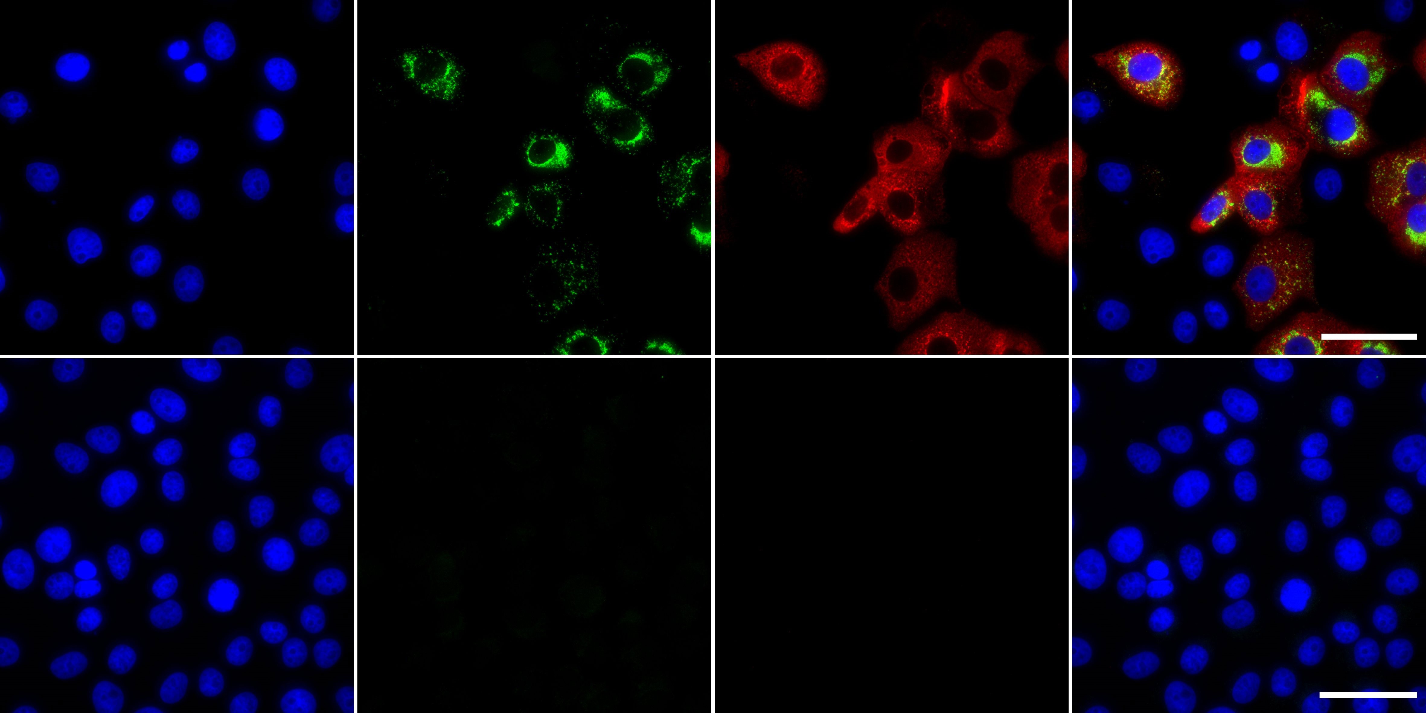 新型コロナウイルス（SARS-CoV-2）を感染させたVero E6細胞におけるウイルスタンパク質の検出