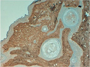抗Collagen Type I 抗体（#600-401-103）を用いたヒト皮膚の免疫染色像