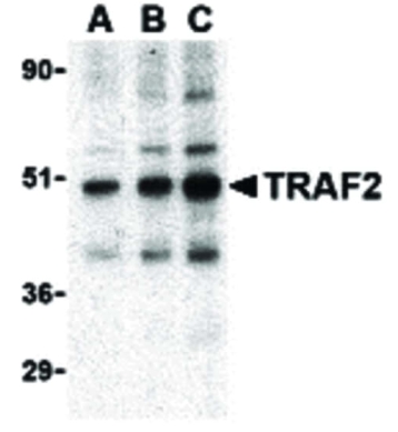 マウス肝組織ライセートを抗TRAF2抗体でブロットした写真