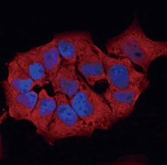 GSTP1細胞蛍光染色例。