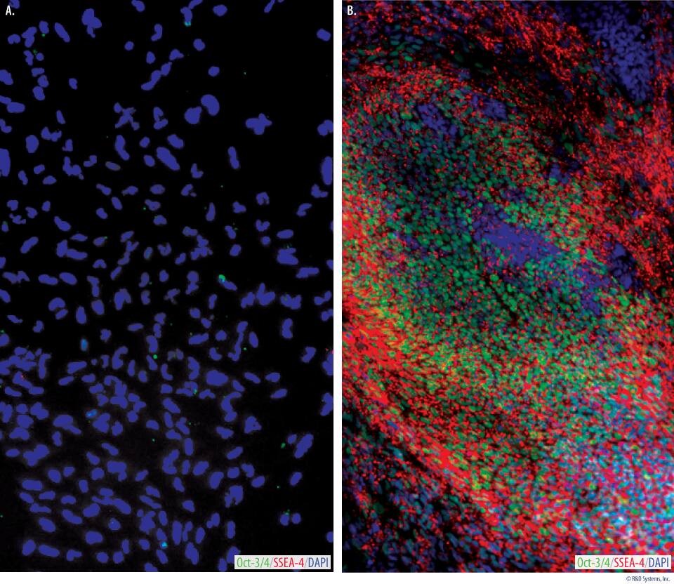 ES細胞の免疫蛍光細胞染色像