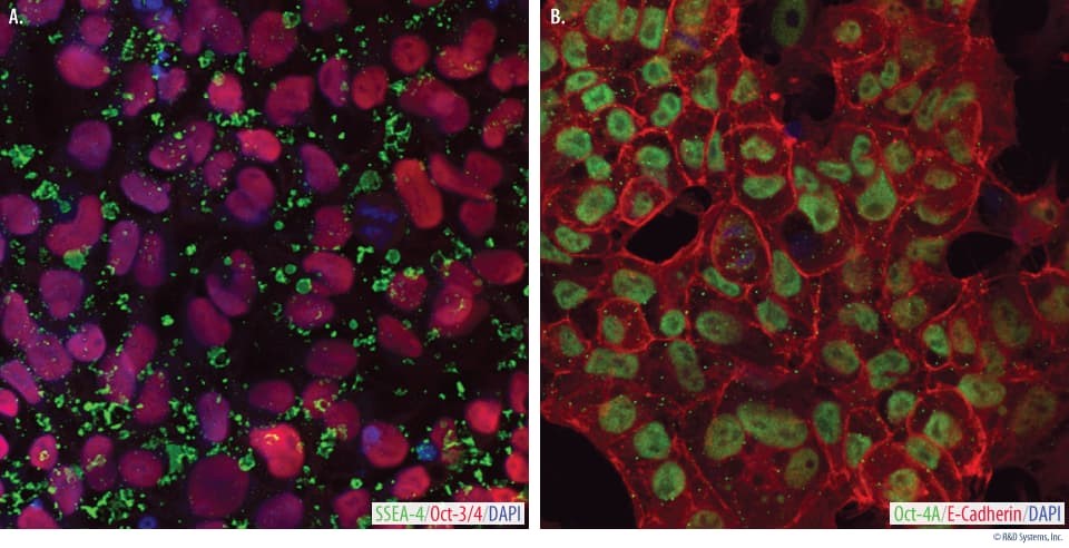 iPS細胞の免疫蛍光細胞染色像