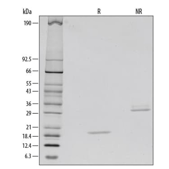 Recombinant Human M-CSF Protein SDS-PAGE