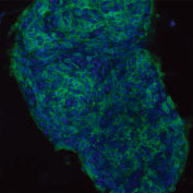 NL493標識抗SSEA-1抗体を用いた未固定D3マウスES細胞の蛍光染色像