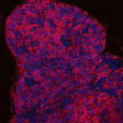 NL557標識抗SSEA-1抗体を用いた未固定D3マウスES細胞蛍光染色像