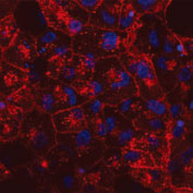 NL557標識抗SSEA-4抗体を用いた未固定BG01VヒトES細胞の蛍光染色像