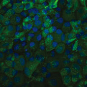 NL493標識抗TRA-1-60抗体を用いた未固定BG01VヒトES細胞の蛍光染色像