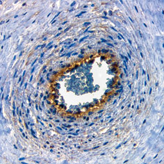 ヒト胎盤組織におけるNectin-4の組織染色像