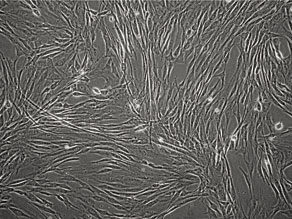 ヒト間葉系幹細胞の形態