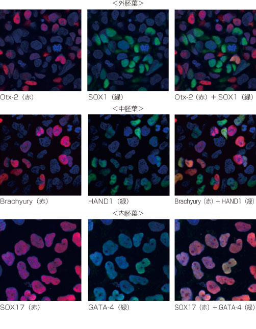 ヒト多能性幹細胞の分化検出用抗体セット
