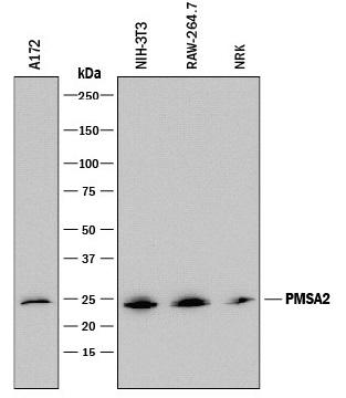 前立腺がん腫瘍マーカー　抗PSMA2抗体