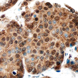 抗Cyclin E2抗体（#MAB7444）を用いたのヒト胸部の免疫染色像_１