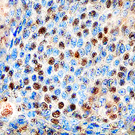 抗Cyclin E2抗体（#MAB7444）を用いたのヒト胸部の免疫染色像_2