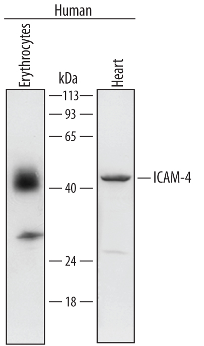 抗ICAM-4抗体 ウエスタンブロット像